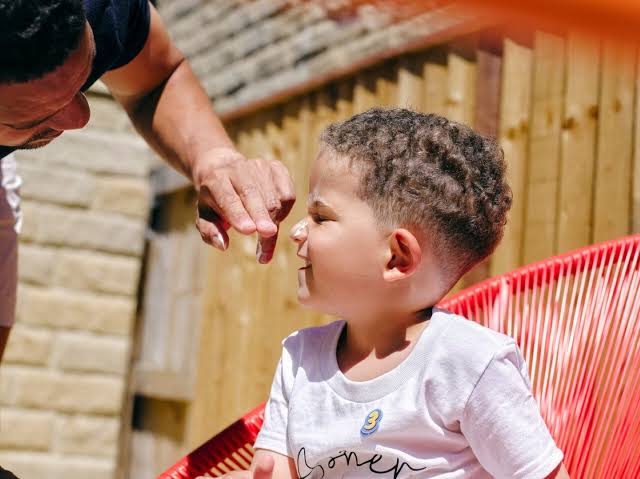 حماية الأطفال من حروق الشمس