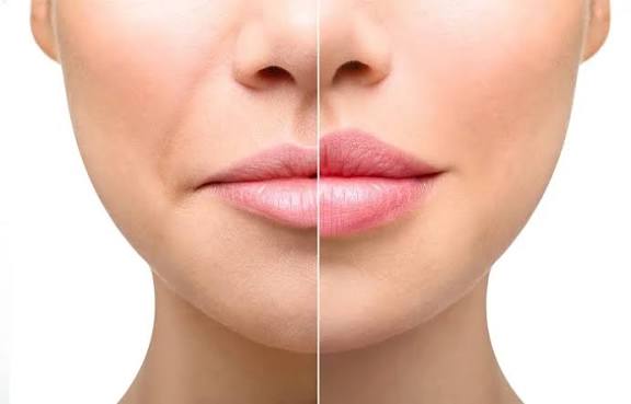 عمليات التجميل
