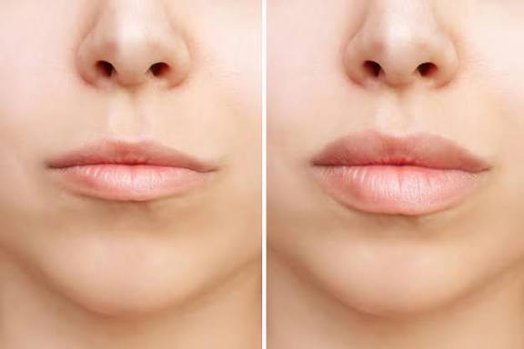 عمليات التجميل