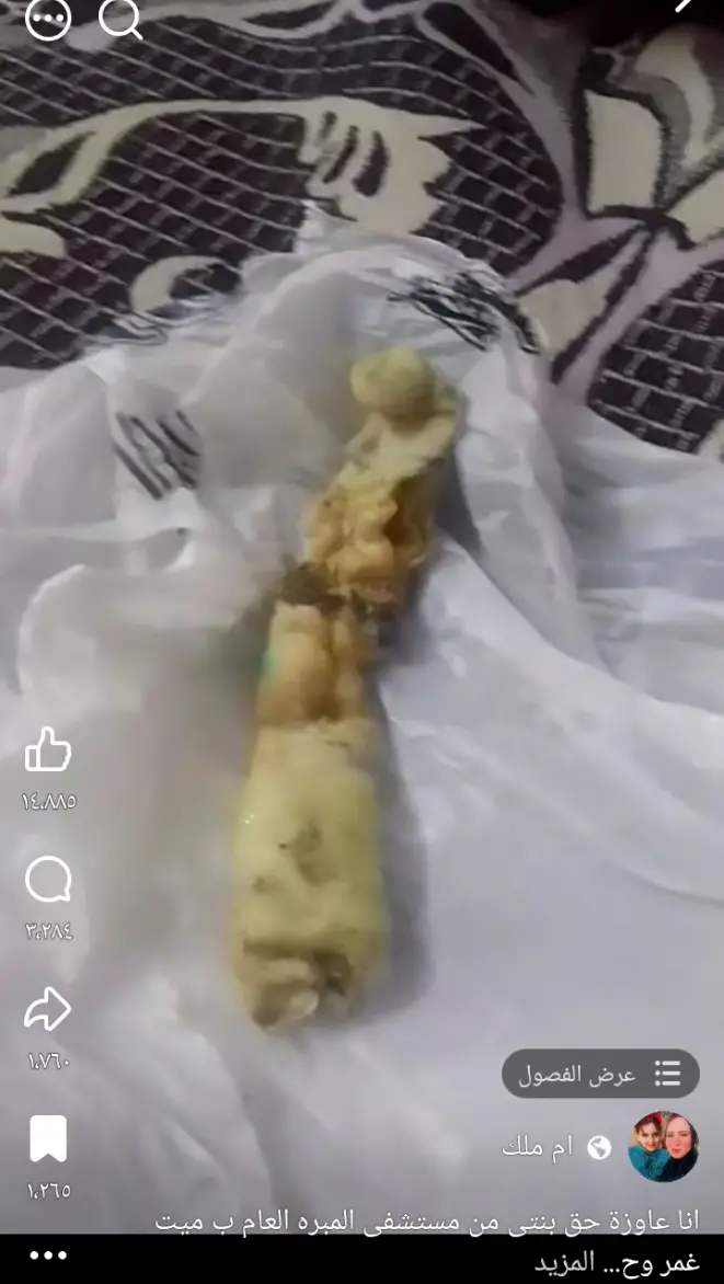 مستشفى المبرة في الغربية