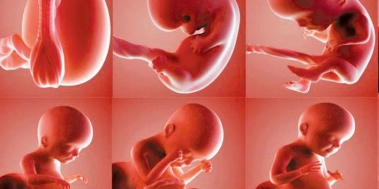 أطباء جامعة المنوفية يستخرجون تكوينًا جنينيًا من معدة طفلة