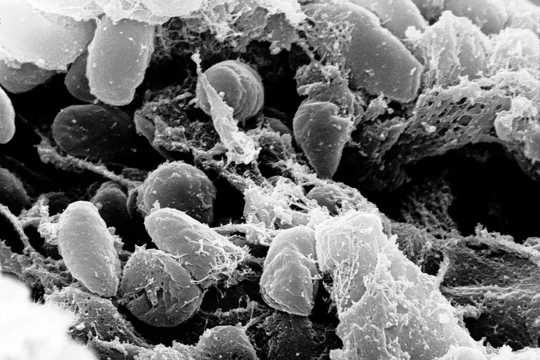 وفاة عاملة مختبر في روسيا تثير مخاوف من الطاعون الرئوي.. ماذا حدث في إيركوتسك؟